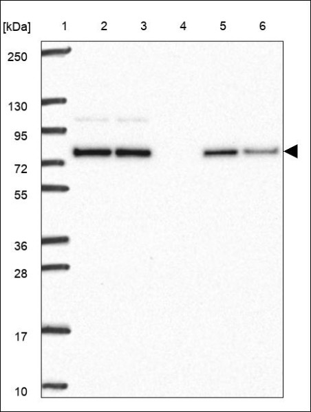 Anti-KLHL2