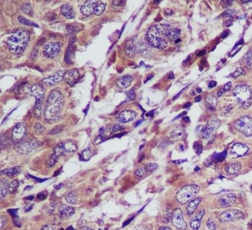 Anti-Caspase 5