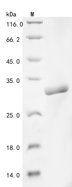 Protein HypA (hypA), partial, Clostridium perfringens, recombinant