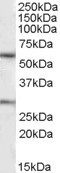 Anti-KCNQ1, C-terminal