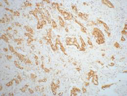 Anti-AMACR Monoclonal