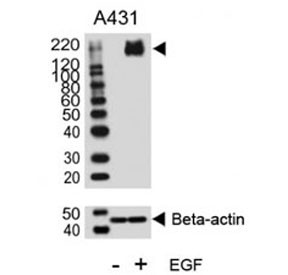 Anti-HER2 / ErbB2 (pY1140)