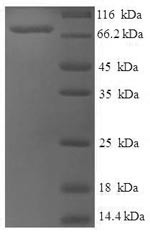 Set1/Ash2 histone methyltransferase complex subunit ASH2 (ASH2L), human, recombinant