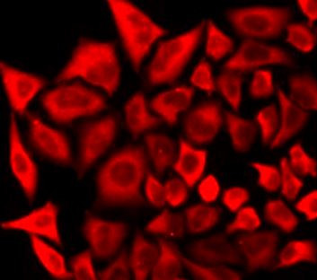 Anti-Natriuretic peptides A