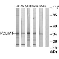 Anti-PDLIM1