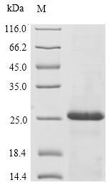 Immunoglobulin J chain (JCHAIN), human, recombinant