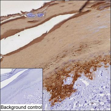 Anti-Cytokeratin-9