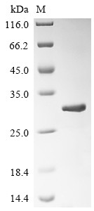 Eukaryotic peptide chain release factor subunit 1 (SUP45), partial, Saccharomyces cerevisiae, recomb