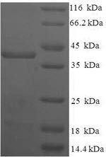 Homeobox protein TGIF2LX (TGIF2LX), human, recombinant
