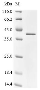 Ribonuclease H1 (RNASEH1), recombinant human