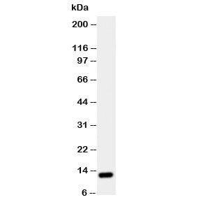 Anti-TFF1 antibody (Estrogen Inducible Protein)