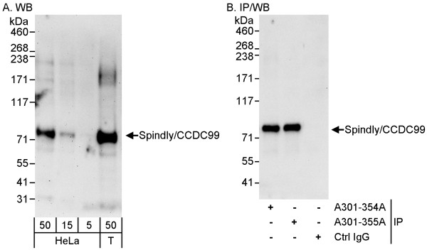 Anti-SPINDLY/CCDC99