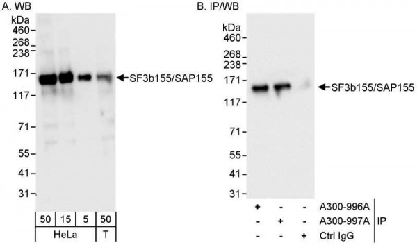 Anti-SF3b155/SAP155