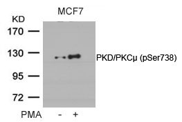 Anti-phospho-PKD/PKC mu (Ser738)