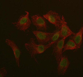 Anti-IQCE / IQ domain-containing protein E
