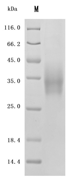 Leukocyte surface antigen CD47 (CD47), partial, recombinant human