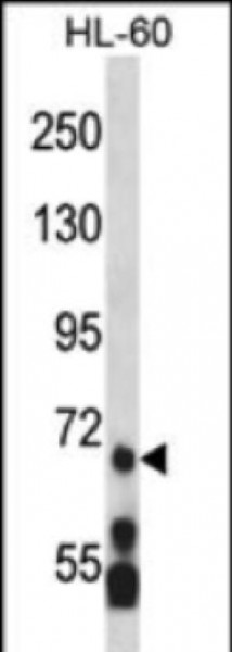 Anti-MLL5, NT (MLL5, KMT2E, Histone-lysine N-methyltransferase MLL5, Lysine N-methyltransferase 2E,