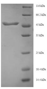 Transforming growth factor beta-3 (TGFB3), partial, human, recombinant