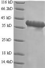 Progonadoliberin-2 (GNRH2), human, recombinant