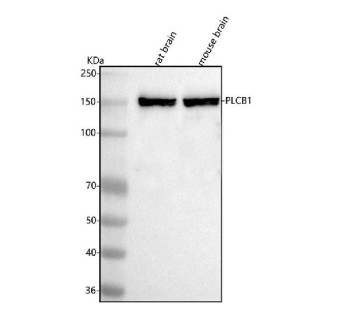 Anti-PLCB1 / Phospholipase C beta 1