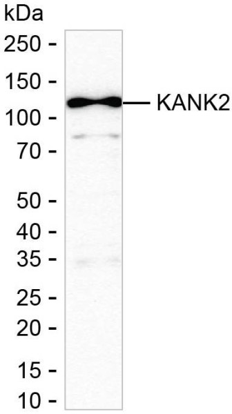 Anti-KANK2