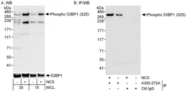 Anti-phospho-53BP1 (Ser25)