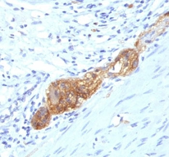 Anti-NCAM / CD56, clone SPM489