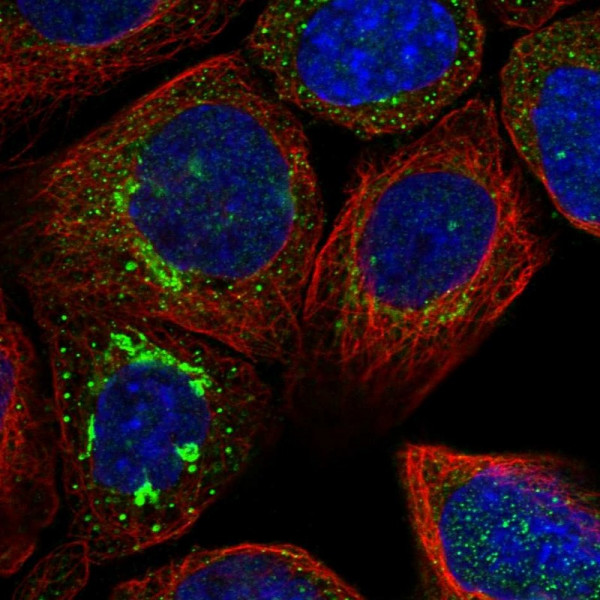 Anti-ATP6V0A1