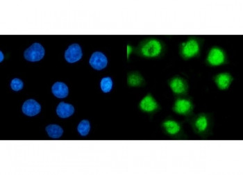 Anti-TBP-1 / PSMC3, clone 4D3