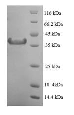 Mitotic spindle assembly checkpoint protein MAD2A (MAD2L1), human, recombinant