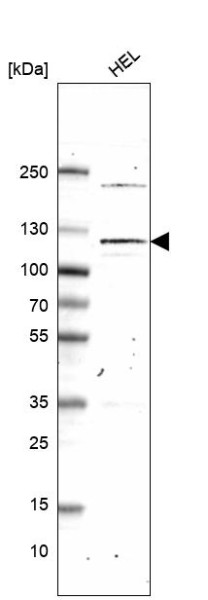 Anti-PMS1, clone CL14436
