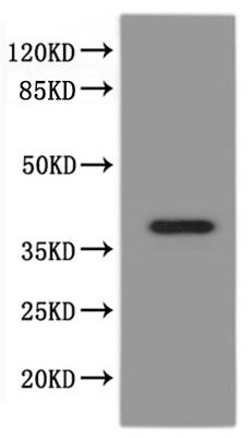 paqr8.L&amp;abhd2.S Heterodimer Protein-VLPs, recombinant Xenopus laevis