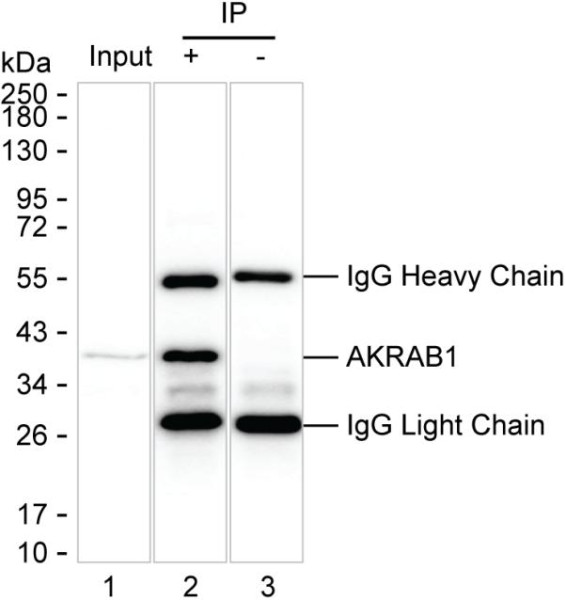 Anti-AKR1B1