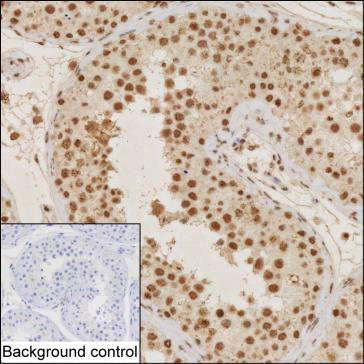 Anti-MDM2 (phospho S166)