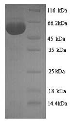 Nucleoprotein (NP), Influenza A virus, recombinant