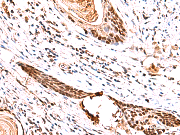 Anti-IRF2BP1