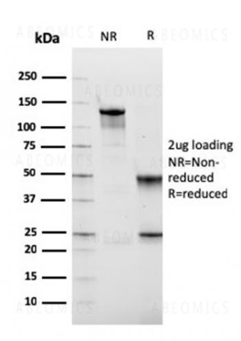 Anti-Fibronectin Monoclonal Antibody (Clone: FN1/2949)