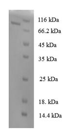 N-acetylgalactosamine-6-sulfatase (GALNS), human, recombinant