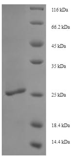 LPS-assembly protein LptD (lptD), partial, Salmonella typhi, recombinant