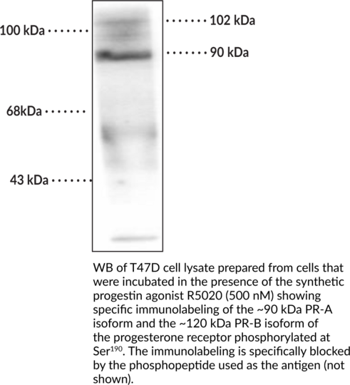 Anti-Progesterone Receptor (Phospho-Ser190) Monoclonal Antibody (Clone 1154)