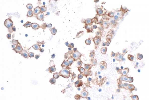 Anti-TIM3 Recombinant Monoclonal