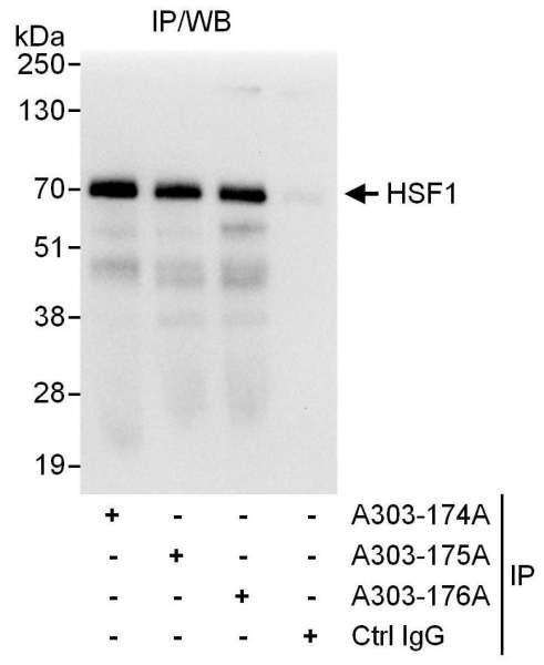Anti-HSF1