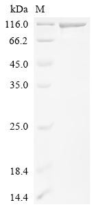 E3 ubiquitin-protein ligase DTX3L (DTX3L), recombinant human