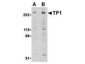 Anti-Telomerase Associated Protein 1 (TEP1)