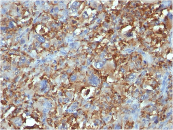 Anti-CD68 (Macrophage Marker), clone C68/684