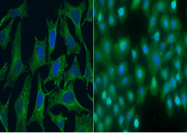 Anti-SPARCL1/SPARC-like 1 Monoclonal Antibody