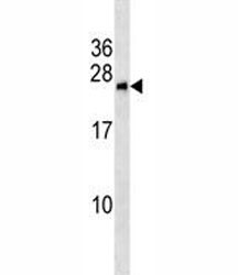 Anti-BNIP1