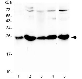 Anti-Plgf / Pgf / Placenta growth factor