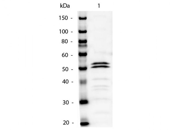 Anti-Mouse IgG1 (Gamma 1 Chain) [Rabbit] Alkaline Phosphatase conjugated
