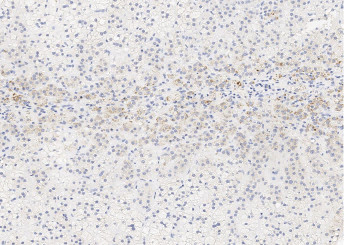 Anti-Alkaline Phosphatase/ALPL Monoclonal Recombinant Antibody